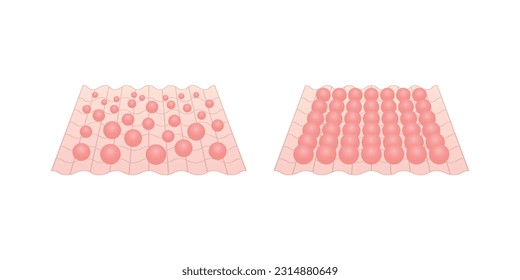 Skin anatomy illustration with molecules on the wavy mesh (net)