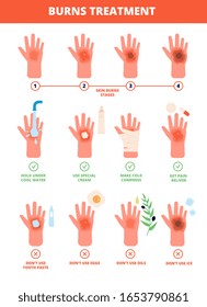 Skin burn. Burned hand treating, protection burns. First aid and treatment, stages of burning. Flat vector medical treat illustration