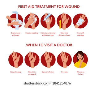 Skin Burn Burned Hand Treating Protection Stock Vector (Royalty Free ...