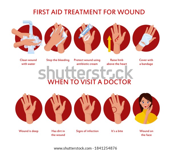 Skin Burn Burned Hand Treating Protection Stock Vector (Royalty Free ...