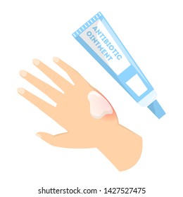 Skin Burn Injury Treatment. First Aid For Damage From Fire Ointment. Red Skin, Thermal Wound. Isolated Vector Illustration In Cartoon Style