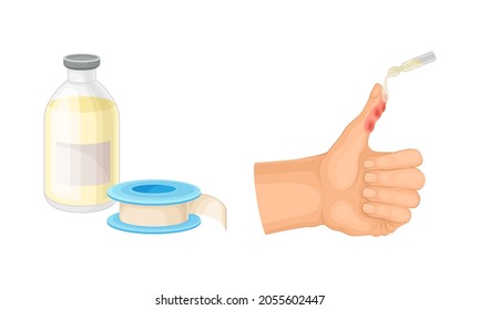 Skin burn injury treatment. First aid for thermal wound. Damaged finger and ointment vector illustration