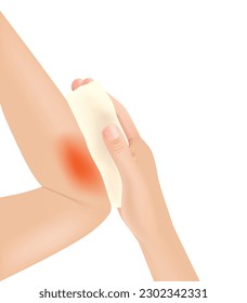 Skin burn injury treatment. First aid for burn wound vector illustration, elbow with skin injury. vector illustration. EPS10.