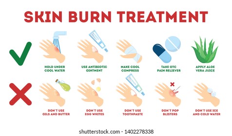 Skin burn injury treatment infographic. First aid for damage from fire. Red skin and blisters, thermal wound. Isolated vector illustration in cartoon style