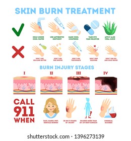 Skin Burn Injury Treatment And Stages Infographic. First Aid For Damage From Fire. Red Skin And Blisters, Thermal Wound. Isolated Vector Illustration In Cartoon Style