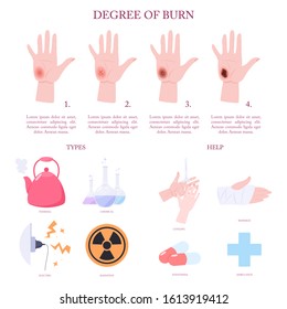 Skin Burn Injury Treatment And Stages Infographic. First Aid For Damage From Fire. Red Skin And Blisters, Thermal Wound. Isolated Vector Illustration In Cartoon Style