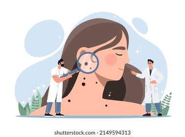 Skin Cancer Concept. Doctors With Magnifying Glasses In Their Hands Examine Girl Skin And Find Melanoma In Form Of Mole. Oncology Or Dermatological Problems. Cartoon Flat Vector Illustration