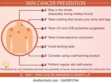 Skin Cancer Disease Prevention Infographic Vector Stock Vector (Royalty ...