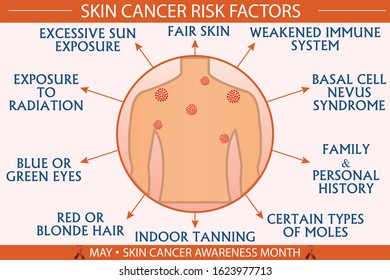 Skin cancer disease risk factors infographic vector illustration. Diagnosis, prevention, symptoms, and treatment concept. Flat style medical template. Hand-drawn awareness month, and health design. 