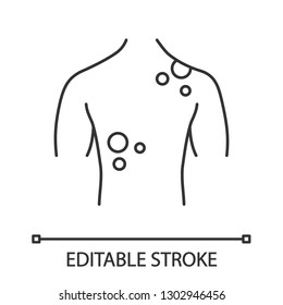 Skin Cancer Linear Icon. Thin Line Illustration. Dermatological Diseases. Rash, Spots On Back. Melanoma. Contour Symbol. Vector Isolated Outline Drawing. Editable Stroke