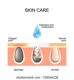 Skin care. Clogged and normal pores. Before and after using scrubs, cleansers and moisturizers