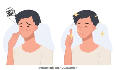 Skin Care Concept.man With Acne.Before And After Acne.Flat Vector 2d Cartoon Character Illustration.