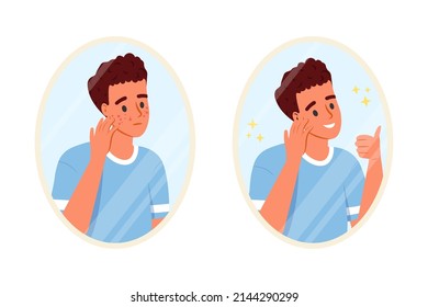 Skin care concept. Teenage boy before and after acne treatment procedure: pimples, blackheads and healthy skin. Young guy looking in bathroom mirror. Teenager skin. Flat cartoon vector illustration.