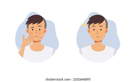 Skin care concept.Before and after acne treatment procedure.A man with acne problem. Flat vector cartoon character illustration.