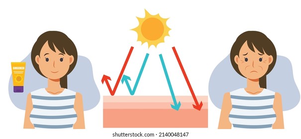 Skin care concept,sun protection.skin damage UV,sunblock ,sunscreen.skin layers.Uva uvb Vector cartoon of comparison about using and not use sunblock product.