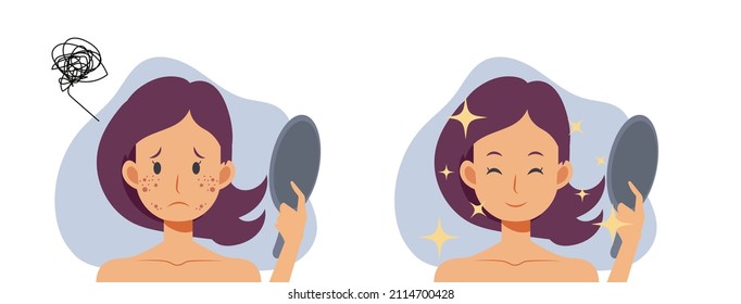 Skin care concept.woman,girl with acne.Before and after acne.Flat vector 2d cartoob character illustration. svg