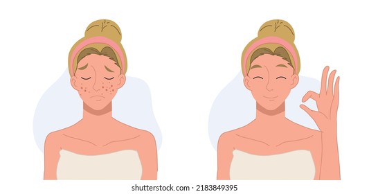 Skin care concept.woman,girl with acne.Before and after acne.Flat vector 2d cartoon character illustration.