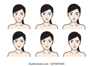 顔のシワイラスト のイラスト素材 画像 ベクター画像 Shutterstock