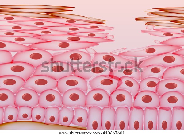 Skin Cell\
Damage, Layers - Vector\
Illustration
