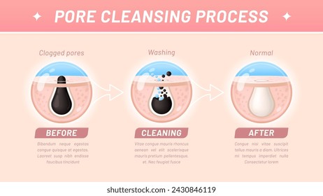 Skin cleaning, pore cleansing process. Vector step-by-step infographics involves removing debris, oil, and dead skin cells from clogged skin pores, exfoliation and washing, before and after visual aid