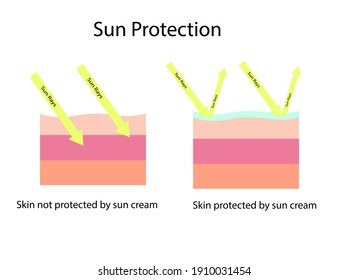 Skin compare between skin with broad-spectrum sunscreen protect both UVA and UVB and and normal sun screen which cannot protect UVA, vector illustration