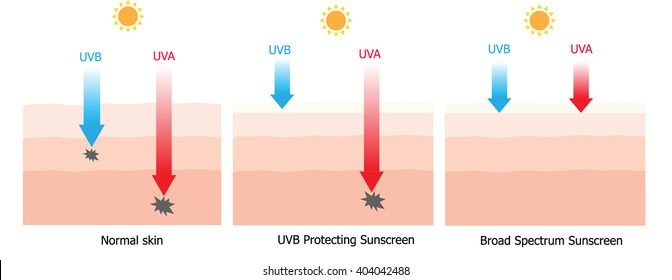 Skin compare between skin with broad-spectrum sunscreen which protect UVA and UVB  to UVB Protecting sunscreen and without sunscreen 