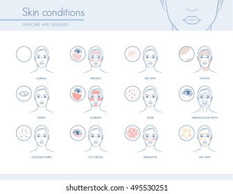 Skin conditions and problems, skincare and dermatology concept