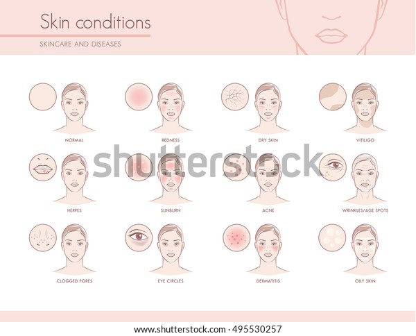 Skin conditions and problems, skincare and
dermatology concept