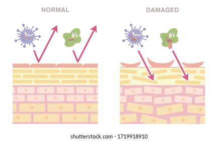 Skin cross section.  Normal and damaged. Pale colored illustration.