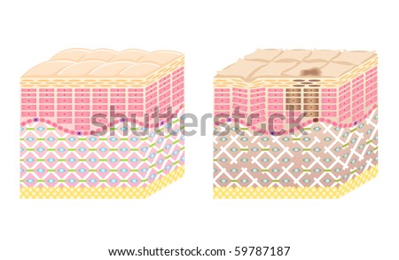 skin cross-section
