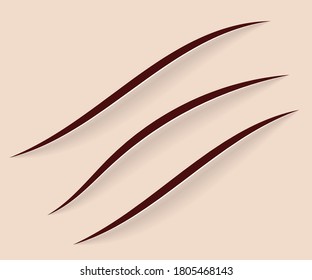 Hautschnitt, Narben und Kratzer. Vektorgrafik.
