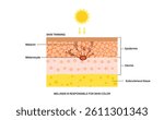 Skin damage from sunburn in the skin layers. Absorbing harmful UVB and UVA rays, injured cells in dermis, epidermis and hypodermis from sunlight. Melanin and melanocytes vector anatomical illustration