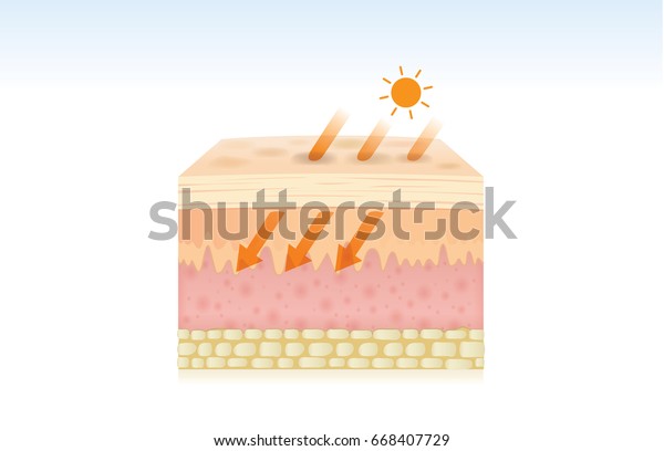 Skin Damaged By Absorption Energy Uv Stock Vector (royalty Free) 668407729