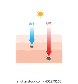 Skin damaged by UVA and UVB ray infographic 