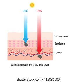 Skin damaged by UVA and UVB ray infographic 