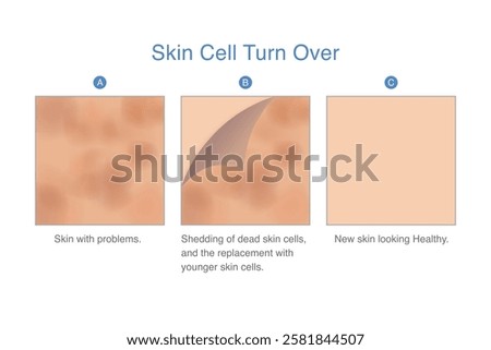 Skin with dark spots are peeled off from top skin surface to reveal new, younger looking skin after recovery. Skin cell turnover. Illustration about Exfoliation and scrub.