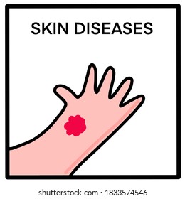 Skin disease hand drawn vector illustration in cartoon doodle style icon arm with spot red card