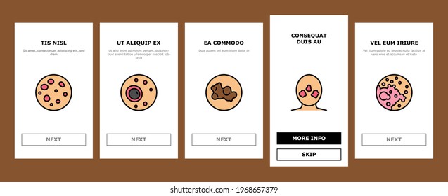 Skin Disease Symptom Onboarding Mobile App Page Screen Vector. Skin Cancer And Acne, Vitiligo And Bruise, Eczema And Chronic Blistering, Herpes And Mycosis Illustrations