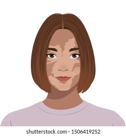 Skin Disease Vitiligo Vector Illustration Stock Vector Royalty Free Skin Disease Vitiligo Vector Illustration Stock Vector Royalty Free
