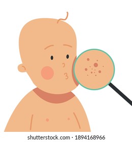 Skin diseases in a child. Children's allergies. Skin diseases, allergies, itching, etc. Doctor examines a rash on a child's skin under a magnifying glass. Flat vector illustration.