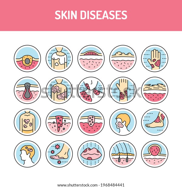 Skin Diseases Line Icons Set Isolated Stock Vector (Royalty Free ...