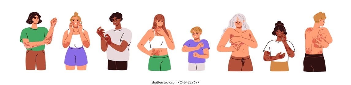 Skin diseases set. Suffering from itch, rash, eczema, allergy, inflammation, dermatitis. People scratching itchy red spots on body. Flat graphic vector illustration isolated on white background