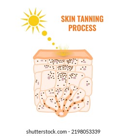Skin epidermis cross-section showing change in melanin distribution in tanned skin. Sun rays and pigment darkening. Hyperpigmentation caused by ultraviolet radiation diagram. Vector illustration.