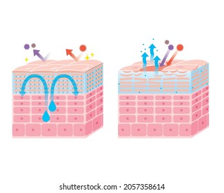 Skin Epidermis, Skin Structure, Skin Diagram, Beauty