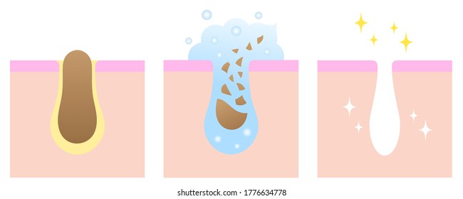 Skin facial cleanser cleanse dirty pore. Isolated on white background