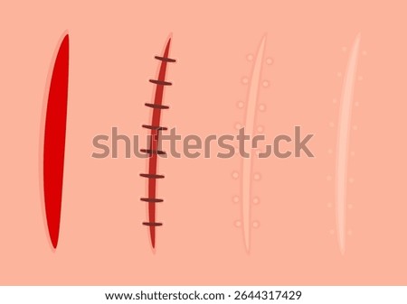 Skin healing process. Fresh wound, surgical sutures and healed scar. Cartoon vector clip art illustration set.