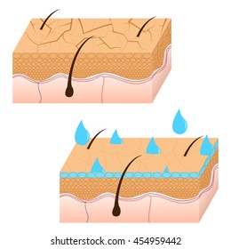 Skin hydration and dry skin sectional view.