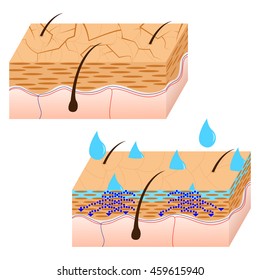 Skin hydration and dry skin sectional view vector illustration.