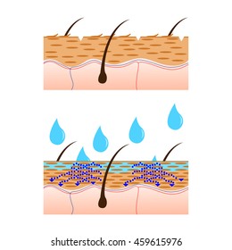 Skin hydration and dry skin sectional view vector illustration.