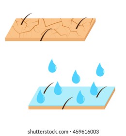 Skin hydration and dry skin sectional view vector illustration.